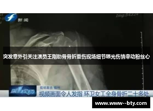 突发意外引关注演员王刚肋骨骨折重伤现场细节曝光伤情牵动粉丝心